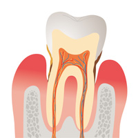 歯周病の進行とは？
